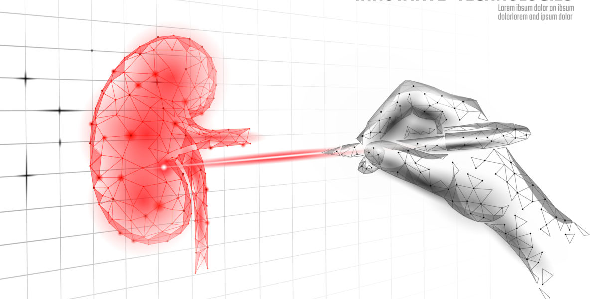 Deseneho de um rim e uma mão com um laser - Calculo renal cirurgia laser