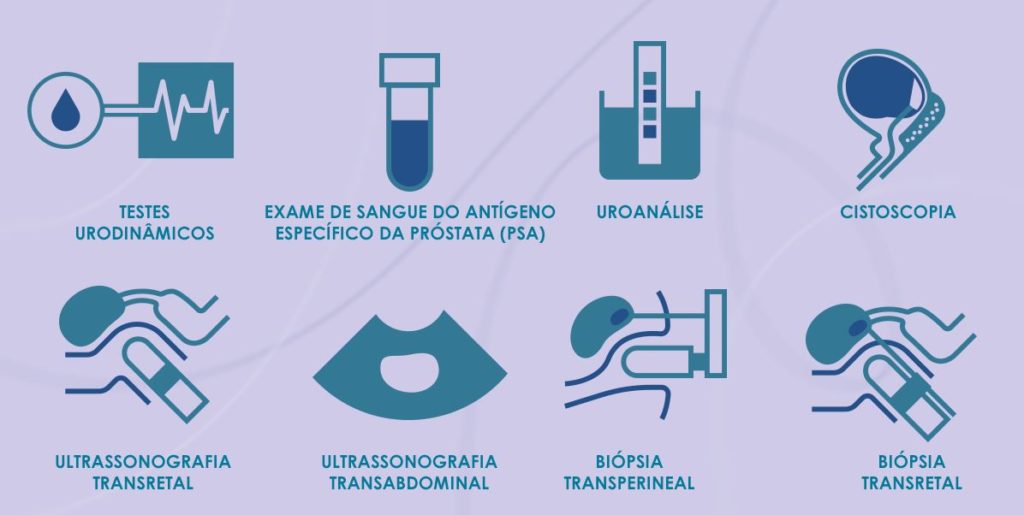 Para confirmar ou descartar qualquer suspeita, o médico vai solicitar exames específicos, como: Testes urodinâmicos; Exame de sangue do antígeno específico da próstata (PSA); Uroanálise; Cistoscopia; Ultrassonografia transretal e transabdominal; Biópsia transperineal e transretal.