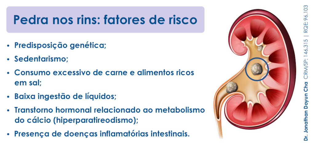 10 Sintomas De Pedra Nos Rins Feminino Dr Jonathan Doyun Cha