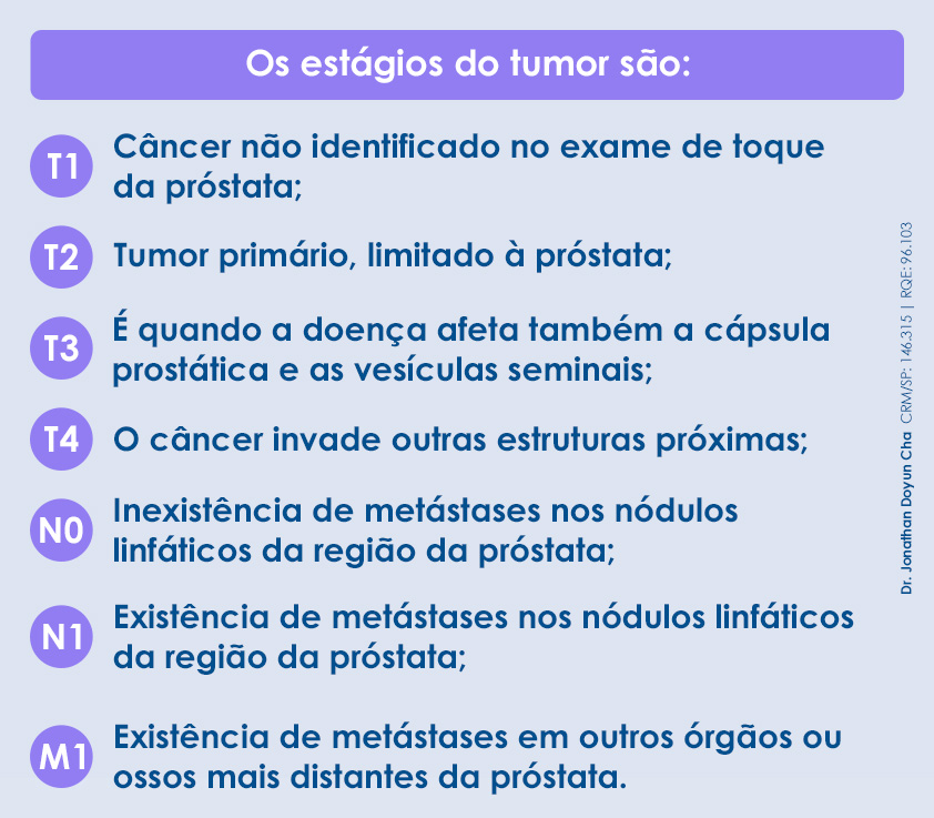 Estágios do câncer de próstata: T1: câncer não identificado no exame de toque da próstata; T2: tumor primário, limitado à próstata; T3: é quando a doença afeta também a cápsula prostática e as vesículas seminais; T4: o câncer invade outras estruturas próximas; N0: inexistência de metástases nos nódulos linfáticos da região da próstata; N1: existência de metástases nos nódulos linfáticos da região da próstata; M1: existência de metástases em outros órgãos ou ossos mais distantes da próstata.