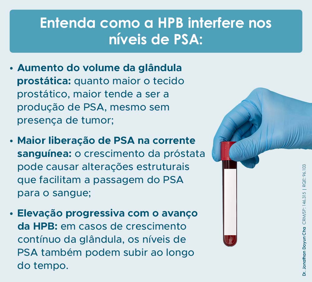 Como a HPB interfere nos níveis de PSA.
