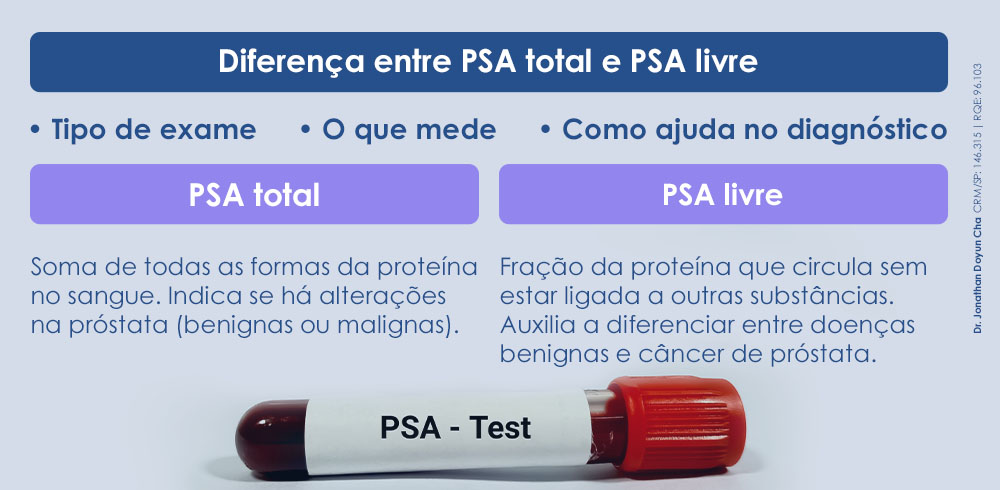 ARTE BLOG - Dr. Jonathan Exame PSA- saiba para que serve e agende seu check-up com um urologista de confiança