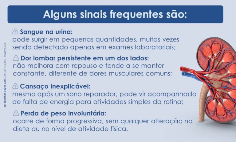 Câncer no rim: sintomas devem ser observados com atenção