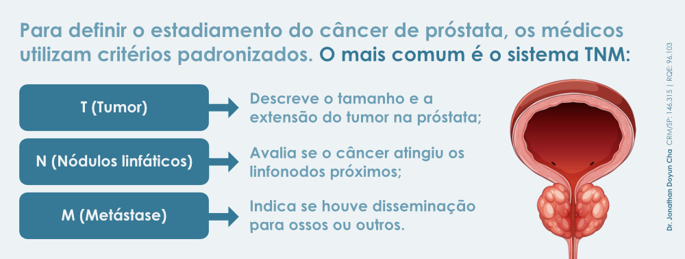 Critérios usados para classificar o câncer de próstata (sistema TNM)